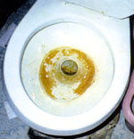 Before - Toilet